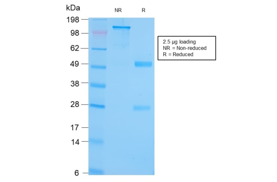 SDS-PAGE - Anti-GRP94 Antibody [HSP90B1/3168R] - BSA and Azide free (A253388) - Antibodies.com