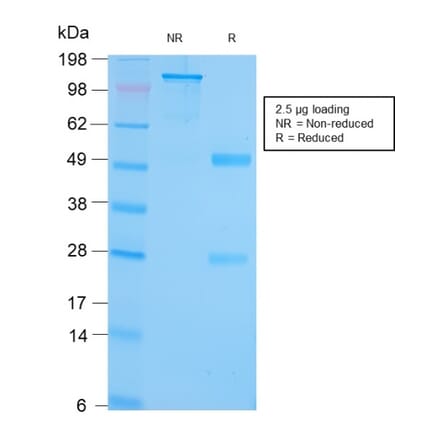SDS-PAGE - Anti-GRP94 Antibody [HSP90B1/3168R] - BSA and Azide free (A253388) - Antibodies.com