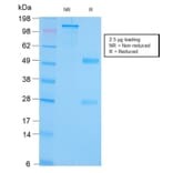 SDS-PAGE - Anti-GRP94 Antibody [HSP90B1/3168R] - BSA and Azide free (A253388) - Antibodies.com