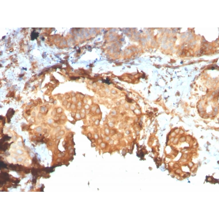 Immunohistochemistry - Anti-GRP94 Antibody [HSP90B1/3168R] - BSA and Azide free (A253388) - Antibodies.com