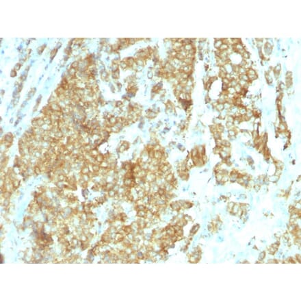 Immunohistochemistry - Anti-GRP94 Antibody [HSP90B1/1192] - BSA and Azide free (A253390) - Antibodies.com