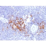 Immunohistochemistry - Anti-TRAF1 Antibody [TRAF1/2770] - BSA and Azide free (A253392) - Antibodies.com