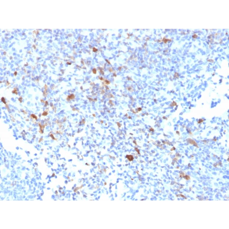 Immunohistochemistry - Anti-TRAF1 Antibody [TRAF1/2770] - BSA and Azide free (A253392) - Antibodies.com