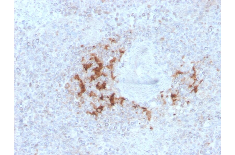 Immunohistochemistry - Anti-TRAF1 Antibody [TRAF1/3298] - BSA and Azide free (A253393) - Antibodies.com