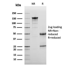 SDS-PAGE - Anti-C3d Antibody [C3D/2891] - BSA and Azide free (A253394) - Antibodies.com