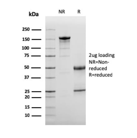 SDS-PAGE - Anti-C3d Antibody [C3D/2891] - BSA and Azide free (A253394) - Antibodies.com