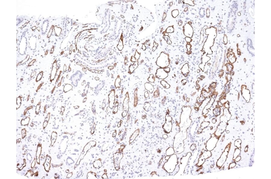 Immunohistochemistry - Anti-C4d Antibody [C4D204] - BSA and Azide free (A253395) - Antibodies.com