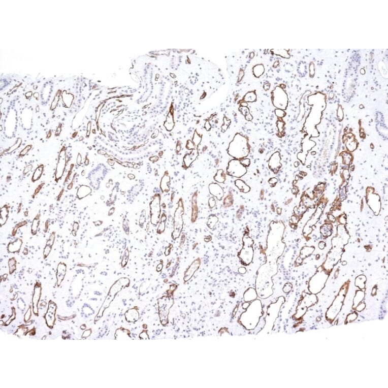 Immunohistochemistry - Anti-C4d Antibody [C4D204] - BSA and Azide free (A253395) - Antibodies.com