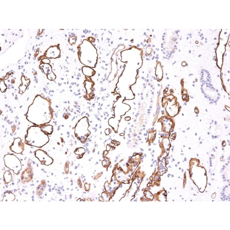 Immunohistochemistry - Anti-C4d Antibody [C4D204] - BSA and Azide free (A253395) - Antibodies.com