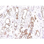 Immunohistochemistry - Anti-C4d Antibody [C4D204] - BSA and Azide free (A253395) - Antibodies.com