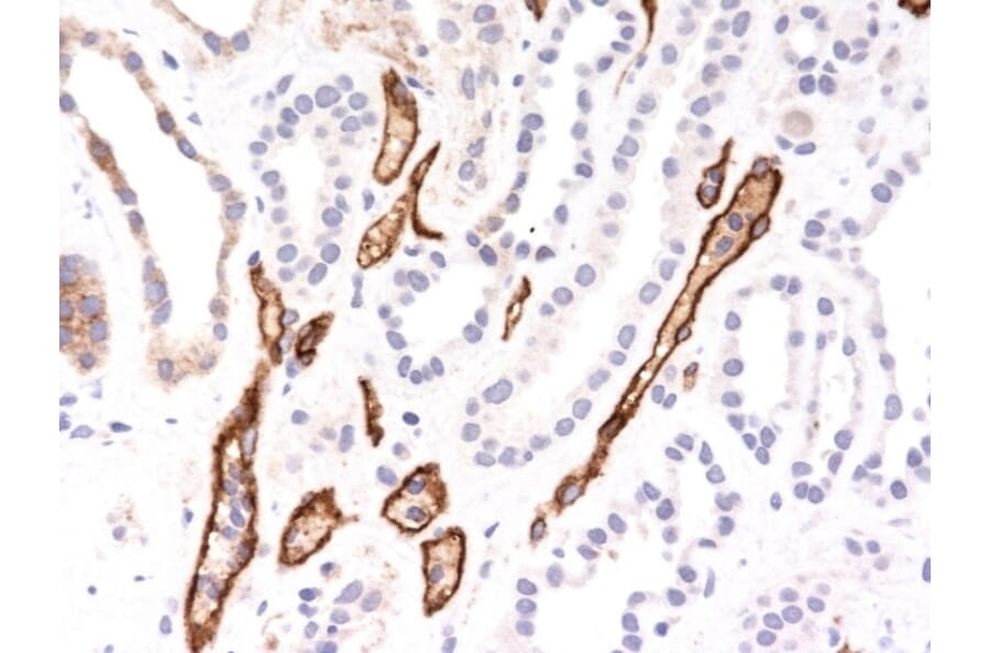 Immunohistochemistry - Anti-C4d Antibody [C4D204] - BSA and Azide free (A253394) - Antibodies.com