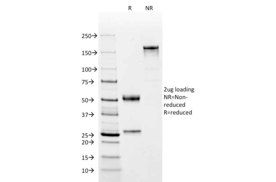 SDS-PAGE - Anti-C4d Antibody [C4D204] - BSA and Azide free (A253395) - Antibodies.com