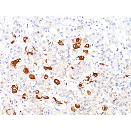 Immunohistochemistry - Anti-TSH beta Antibody [TSHb/1317] - BSA and Azide free (A253396) - Antibodies.com