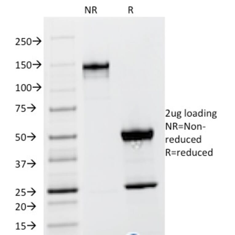 SDS-PAGE - Anti-TSH beta Antibody [TSHb/1317] - BSA and Azide free (A253397) - Antibodies.com