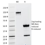 SDS-PAGE - Anti-TSH beta Antibody [TSHb/1317] - BSA and Azide free (A253397) - Antibodies.com
