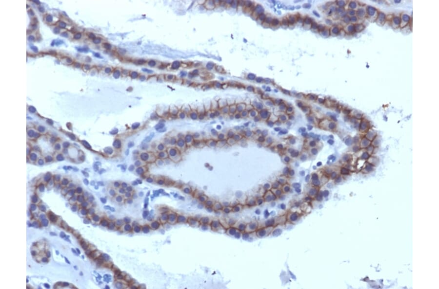Immunohistochemistry - Anti-TSH Receptor Antibody [SPM223] - BSA and Azide free (A253397) - Antibodies.com