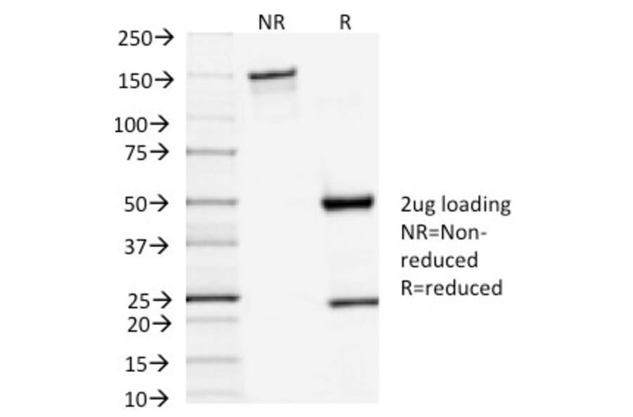 SDS-PAGE - Anti-TSH Receptor Antibody [TSHRA/1402] - BSA and Azide free (A253399) - Antibodies.com