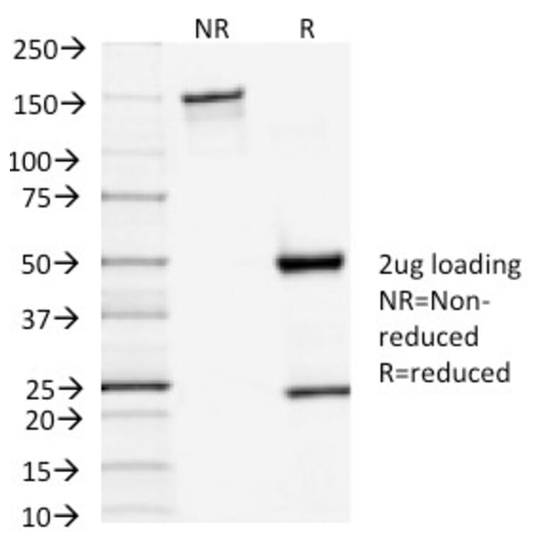 SDS-PAGE - Anti-TSH Receptor Antibody [TSHRA/1402] - BSA and Azide free (A253399) - Antibodies.com