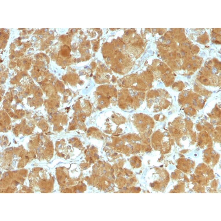 Immunohistochemistry - Anti-TSH Receptor Antibody [TSHRA/1402] - BSA and Azide free (A253398) - Antibodies.com