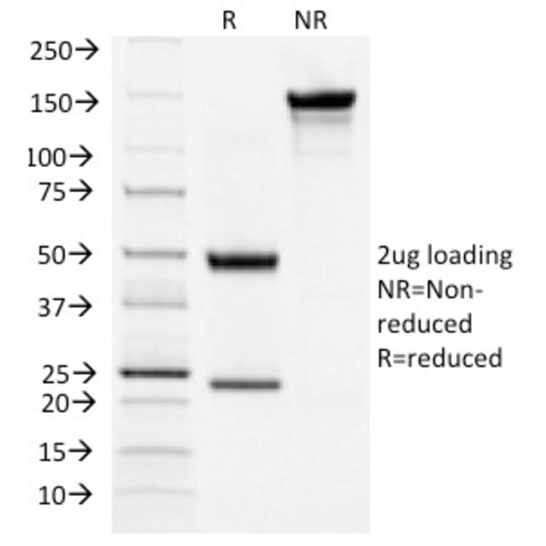 SDS-PAGE - Anti-TSH Receptor Antibody [TSHRB/1404] - BSA and Azide free (A253399) - Antibodies.com