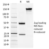 SDS-PAGE - Anti-TSH Receptor Antibody [TSHRB/1404] - BSA and Azide free (A253399) - Antibodies.com