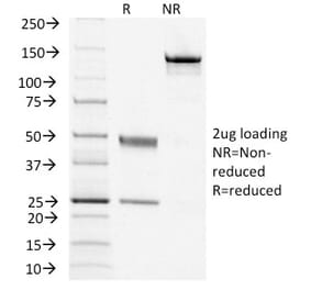 SDS-PAGE - Anti-TSH Receptor Antibody [TSHRB/1405] - BSA and Azide free (A253401) - Antibodies.com