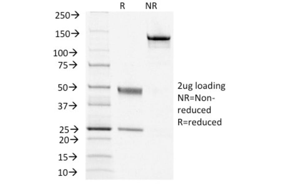 SDS-PAGE - Anti-TSH Receptor Antibody [TSHRB/1405] - BSA and Azide free (A253401) - Antibodies.com
