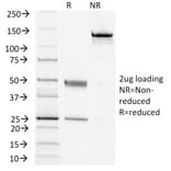 SDS-PAGE - Anti-TSH Receptor Antibody [TSHRB/1405] - BSA and Azide free (A253401) - Antibodies.com