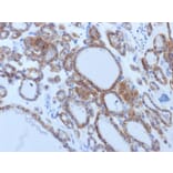 Immunohistochemistry - Anti-TSH Receptor Antibody [TSHRB/1405] - BSA and Azide free (A253400) - Antibodies.com