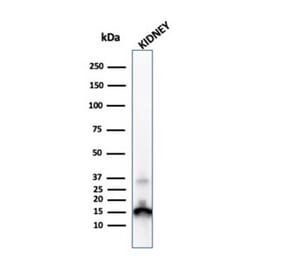 Western Blot - Anti-Transthyretin Antibody [CPTC-TTR-1] - BSA and Azide free (A253403) - Antibodies.com