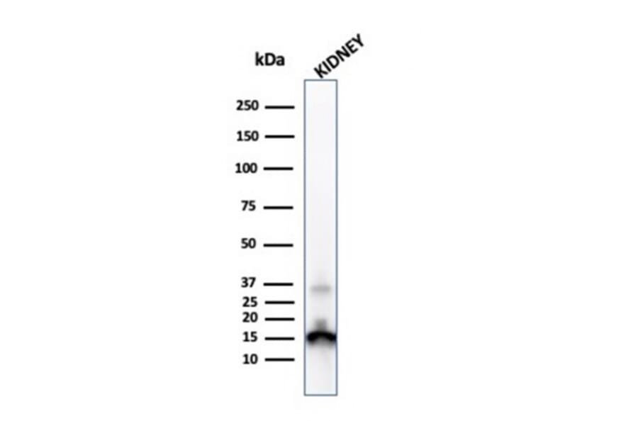 Western Blot - Anti-Transthyretin Antibody [CPTC-TTR-1] - BSA and Azide free (A253403) - Antibodies.com