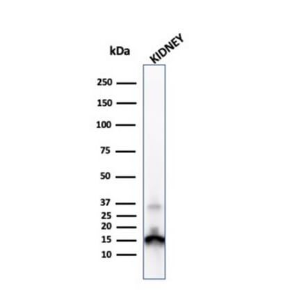 Western Blot - Anti-Transthyretin Antibody [CPTC-TTR-1] - BSA and Azide free (A253403) - Antibodies.com