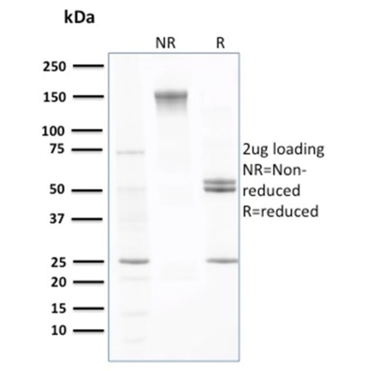 SDS-PAGE - Anti-Transthyretin Antibody [CPTC-TTR-1] - BSA and Azide free (A253403) - Antibodies.com