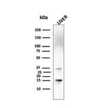 Western Blot - Anti-Transthyretin Antibody [CPTC-TTR-1] - BSA and Azide free (A253403) - Antibodies.com