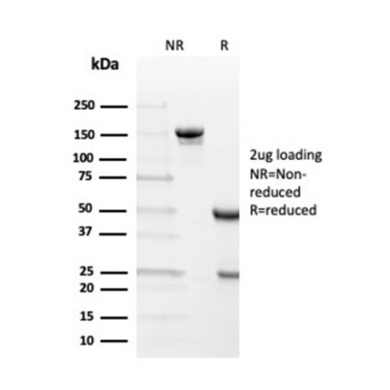 SDS-PAGE - Anti-Transthyretin Antibody [TTR/4292] - BSA and Azide free (A253404) - Antibodies.com