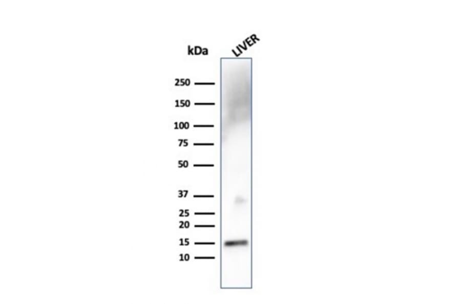 Western Blot - Anti-Transthyretin Antibody [TTR/4292] - BSA and Azide free (A253404) - Antibodies.com