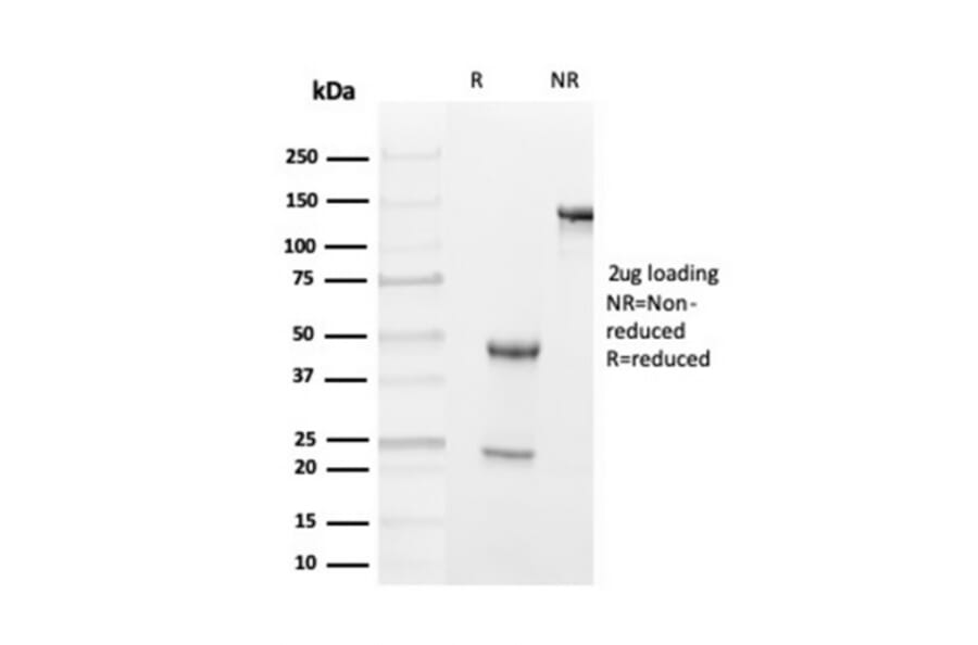 SDS-PAGE - Anti-Transthyretin Antibody [TTR/4293] - BSA and Azide free (A253405) - Antibodies.com