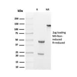 SDS-PAGE - Anti-Transthyretin Antibody [TTR/4293] - BSA and Azide free (A253405) - Antibodies.com
