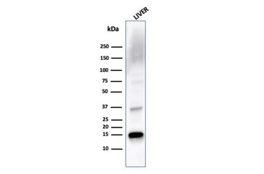 Western Blot - Anti-Transthyretin Antibody [TTR/4293] - BSA and Azide free (A253405) - Antibodies.com