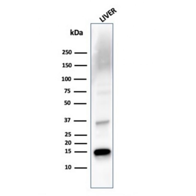 Western Blot - Anti-Transthyretin Antibody [TTR/4293] - BSA and Azide free (A253405) - Antibodies.com