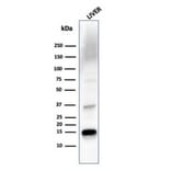 Western Blot - Anti-Transthyretin Antibody [TTR/4293] - BSA and Azide free (A253405) - Antibodies.com