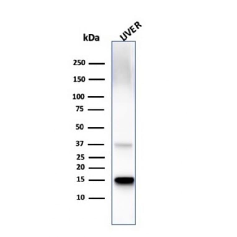 Western Blot - Anti-Transthyretin Antibody [TTR/4295] - BSA and Azide free (A253406) - Antibodies.com