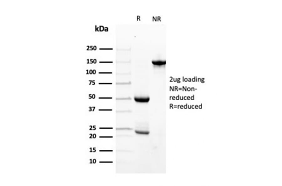 SDS-PAGE - Anti-Transthyretin Antibody [TTR/4296] - BSA and Azide free (A253407) - Antibodies.com
