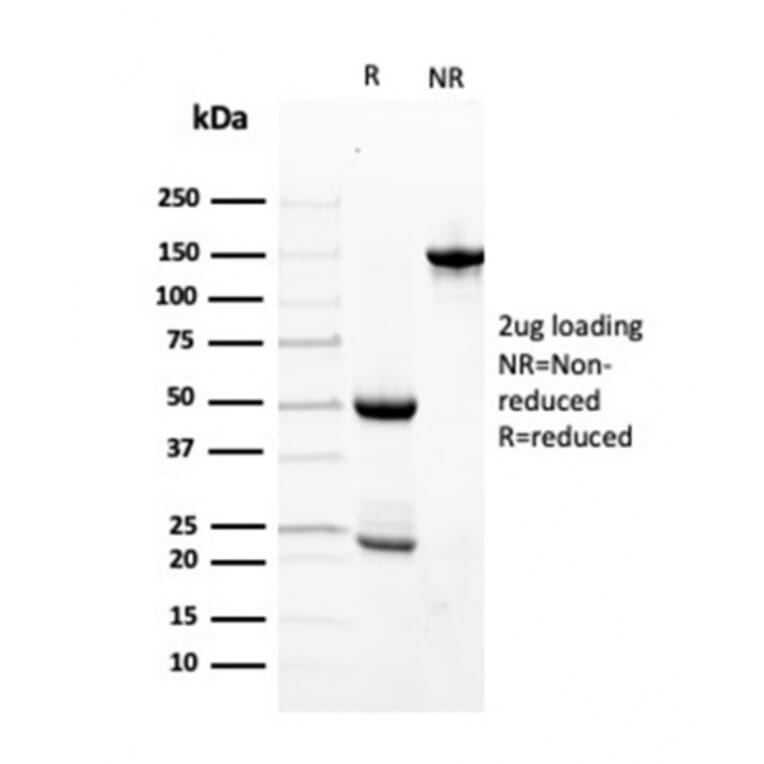 SDS-PAGE - Anti-Transthyretin Antibody [TTR/4296] - BSA and Azide free (A253407) - Antibodies.com