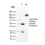 SDS-PAGE - Anti-Transthyretin Antibody [TTR/4296] - BSA and Azide free (A253407) - Antibodies.com