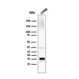 Western Blot - Anti-Transthyretin Antibody [TTR/4296] - BSA and Azide free (A253407) - Antibodies.com