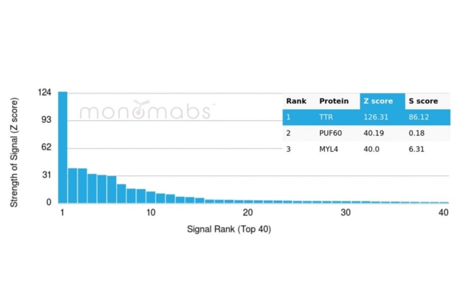 Protein Array - Anti-Transthyretin Antibody [TTR/4296] - BSA and Azide free (A253406) - Antibodies.com