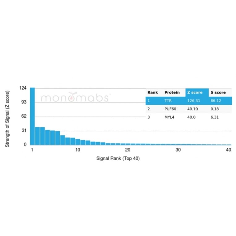 Protein Array - Anti-Transthyretin Antibody [TTR/4296] - BSA and Azide free (A253406) - Antibodies.com