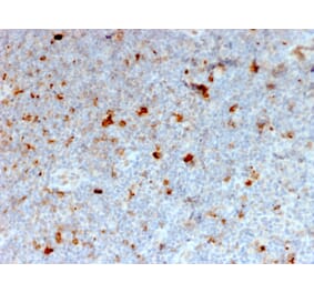 Immunohistochemistry - Anti-CD134 Antibody [OX40/2721] - BSA and Azide free (A253409) - Antibodies.com