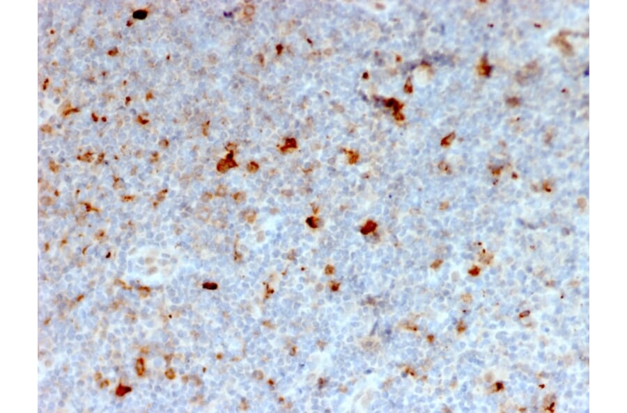Immunohistochemistry - Anti-CD134 Antibody [OX40/2721] - BSA and Azide free (A253409) - Antibodies.com